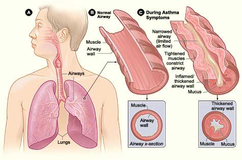 home remedies for asthma